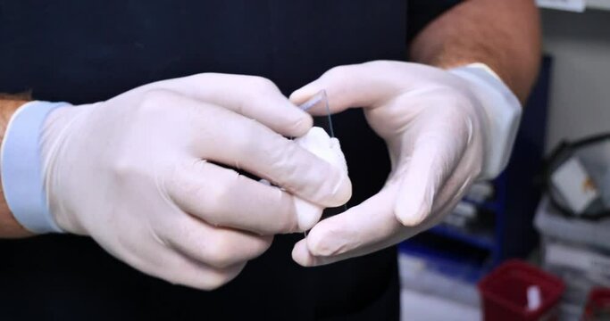 A laboratory technician degreases slides before performing a blood test. The doctor prepares slides for applying a blood smear before conducting a clinical analysis.