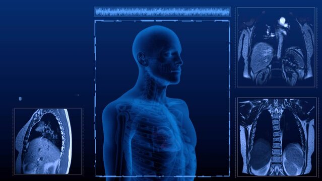 A medically anatomically correct Magnetic resonance scan of the coronary artery of the heart. 3D rendering of a chest X-ray scan.