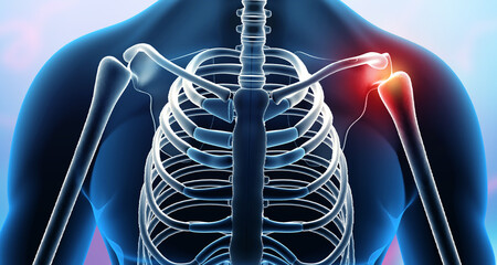 Shoulder Arthritis,Shoulder pain. 3d illustration. - obrazy, fototapety, plakaty