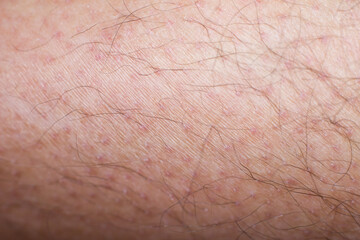 Human skin with hairs, human skin in macro