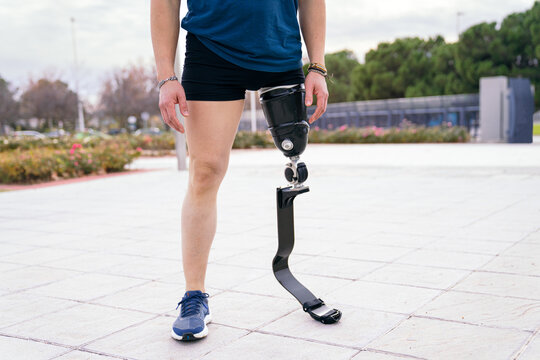 Unrecognizable male athlete with running blade prosthetic stands poised for training in urban park, embodying adaptive sports. - Powered by Adobe