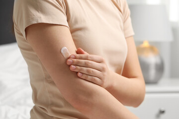 Young woman with dry skin applying cream onto her arm indoors, closeup - obrazy, fototapety, plakaty