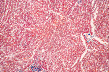 Structure of Tissue of Spleen Human, Liver Human and Kidney Human under the microscope in Lab.