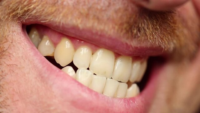 A man's teeth in macro view