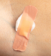 Adhesive plaster with cotton wool after an injection on the arm
