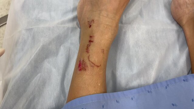 Close up on wounded leg and hands of nurse with latex gloves treating injury. Hospital emergency, accident concepts