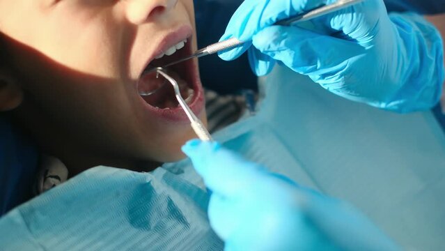 Compassionate female dentist assesses tooth decay in a young patient using a dental probe and angled mirror.