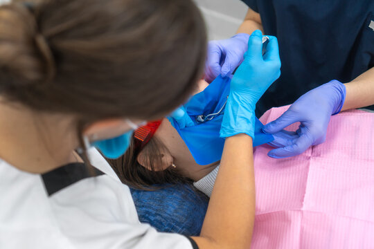 Process of installing a dental cofferdam for dental treatment on the jaw of a young woman wearing protective glasses in dentistry. Dentist uses a dental dam to isolate the tooth