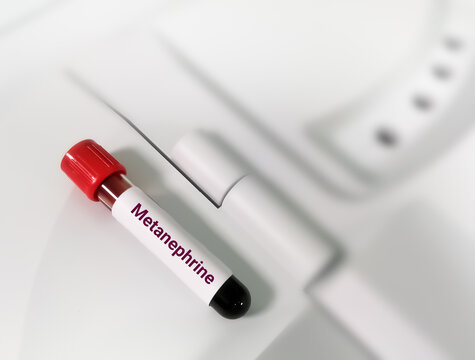 Metanephrine blood test. Metanephrine are made when your body breaks down hormones called catecholamines. Catecholamines help your body respond to stress