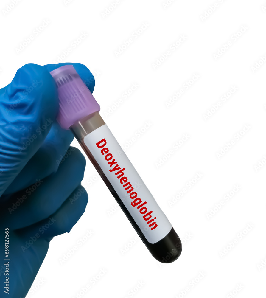 Poster deoxyhemoglobin or reduced hemoglobin (rhb) test, hemoglobin which is not combined with oxygen