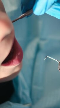 While assessing a young patient for tooth decay, a compassionate female dentist employs a dental probe and angled mirror.
