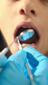 A compassionate female dentist assesses tooth decay in a young patient using a dental probe and angled mirror.