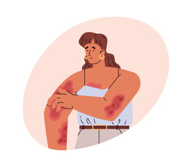 Woman with skin diseases. Vector illustration in flat style on white.
