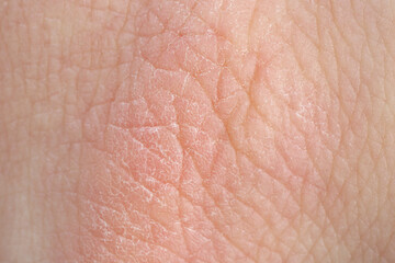 Fototapeta premium Texture of healthy skin as background, macro view