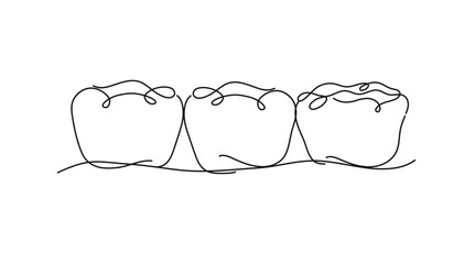 Implanted teeth with crown bridge illustration drawing in flat line style on white background