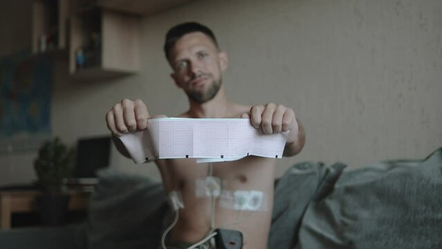 Distressed man with holter heart monitor attached shows cardiogram at camera. Poor health and heart disease due to stress in young adults. Control and monitoring of cardiovascular system at home.
