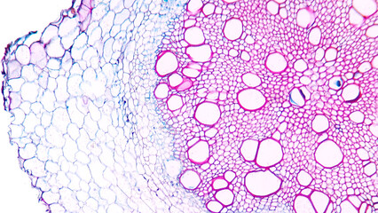 Sunflower (Helianthus sp) old root cross section. Dicot root histology for education. Selective...