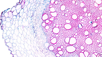 Sunflower (Helianthus sp) old root cross section. Dicot root histology for education. Selective...