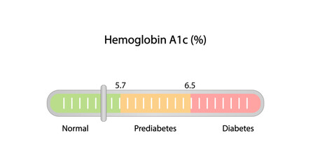 Hemoglobin A1C, HbA1c test results, glycated hemoglobin, A1C Blood Sugar Test, Diabetes Mellitus. Vector illustration.	
