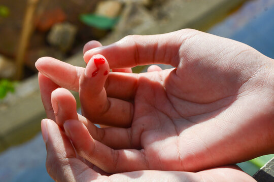 Photo of a finger cut, cut by a knife, bleeding fresh red blood