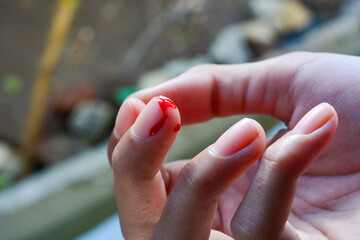 Photo of a finger cut, cut by a knife, bleeding fresh red blood