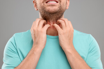 Fototapeta premium Allergy symptom. Man scratching his neck on light grey background, closeup