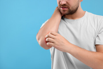 Allergy symptom. Man scratching his arm on light blue background, closeup. Space for text