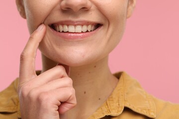 Woman showing her clean teeth and smiling on pink background, closeup