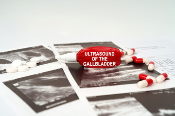 On the ultrasound pictures there are pills and a pen with the inscription - Ultrasound of the gallbladder