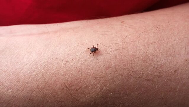 Small Insect Parasite Mite Crawls On a Man's Palm Hand. Tick on the Skin Close Up. Ticks Carry Encephalitis Disease. Blood-sucking Mite Tick Creepers on the Human Skin