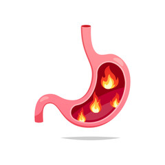 Flame in human stomach vector isolated on white background.