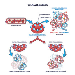 Thalassemia blood disease as hemoglobin structure deletion outline diagram. Labeled educational scheme with alpha and beta globin subunits disorder vector illustration. Medical illness explanation.