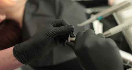 Close-up of dentist's hands holding dental tools and toothpaste. The use of sterile materials and the process of professional teeth cleaning in a dental clinic.