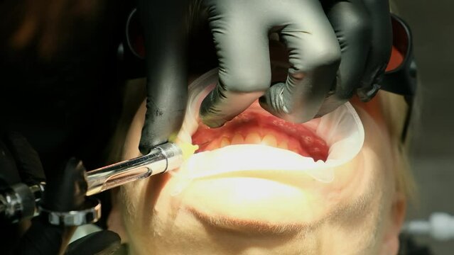 A dentist gives an injection of anesthesia to a girl patient before dental treatment. Close-up.
