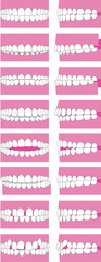 歯並び、歯列の不正咬合の種類。正面と横のベクターイラスト © hiro