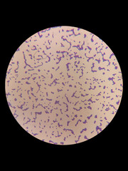 Lactic acid bacteria under a microscope, gram staining