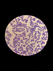 A smear of yeasts Wickerhamomyces anomalus under a microscope is stained with gentian violet or Gram
