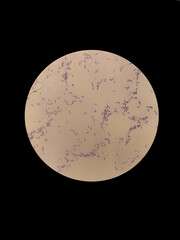 Lactic acid bacteria under a microscope, gram staining