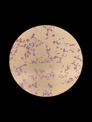 Lactic acid bacteria under a microscope, gram staining