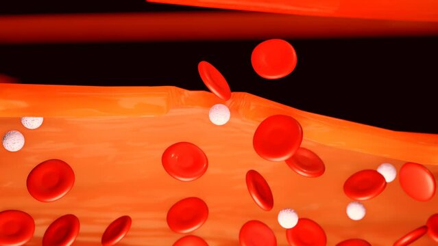 3d animation of hemophilia leads to spontaneous bleeding as well as bleeding following injuries or surgery 