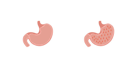 Obraz premium Gastroenteritis Disease Scientific Design. Vector Illustration.