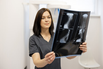 Doctor examines an x-ray of the cervical spine in a medical office