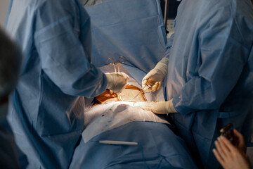 Two surgeons operates abdominal area of a patient. Concept of real operation and surgical...