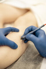 Phlebologist makes injections into a vein, performing sclerotherapy on the veins of women's leg,...