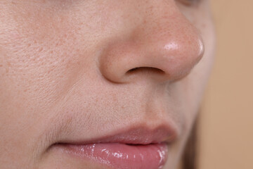 Closeup view of woman with blackheads on her nose against beige background