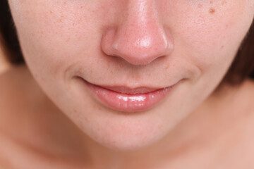 Fototapeta premium Closeup view of woman with blackheads on her nose