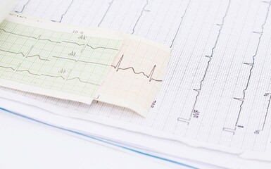 heart rhythm ekg note on paper Doctors use it to analyze heart disease treatments. illustration on a white background