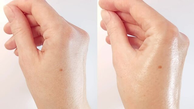 Female hand skin care. Comparison of dry hand skin and healthy moisturized after applying hand cream, lotion, oil, serum, milk, or other skin care beauty products. Before and After