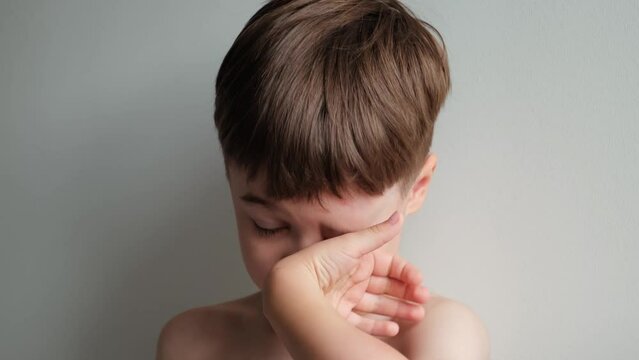 Little boy looking at the camera rubbing and scratching his swollen eye from an insect bite. Unhappy view. Angioedema. Allergic response. Red inflamed upper eyelid. Inflammation. Itching bites. 4K