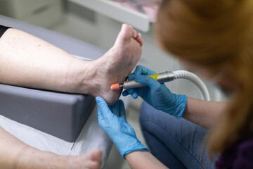 A beautician uses a nail milling machine to give a pedicure to a client's feet.